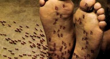 Ευαίσθητες διαταραχές για την οσφυϊκή balosteochondrosis