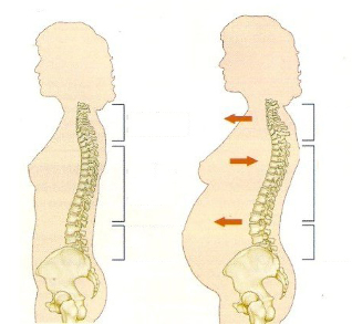 Οστεοχόνδρωση κατά τη διάρκεια της εγκυμοσύνης